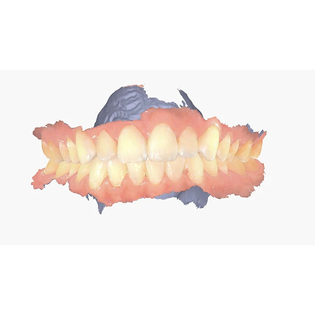 Интраоральный сканер Shining 3D Aoralscan Elite